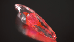 Wurzelkanalanatomie: Visualisierung in der Endodontie