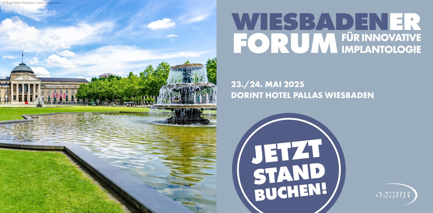 Aktuelle Trends in der Implantologie in Wiesbaden: Jetzt buchen!