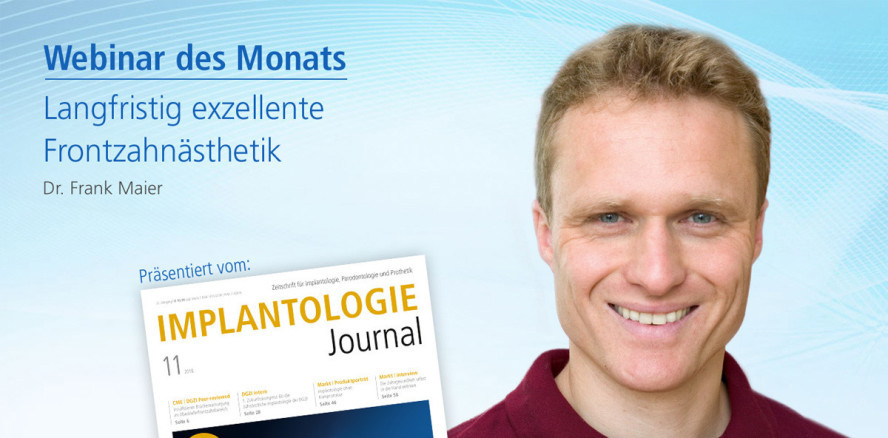 Webinar: Langfristig exzellente Frontzahnästhetik