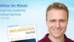 Webinar: Langfristig exzellente Frontzahnästhetik