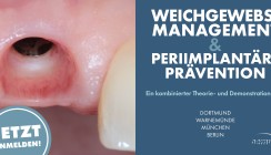 Perfekte Rot-Weiß-Ästhetik – nachhaltiger Implantaterfolg beginnt im Weichgewebe