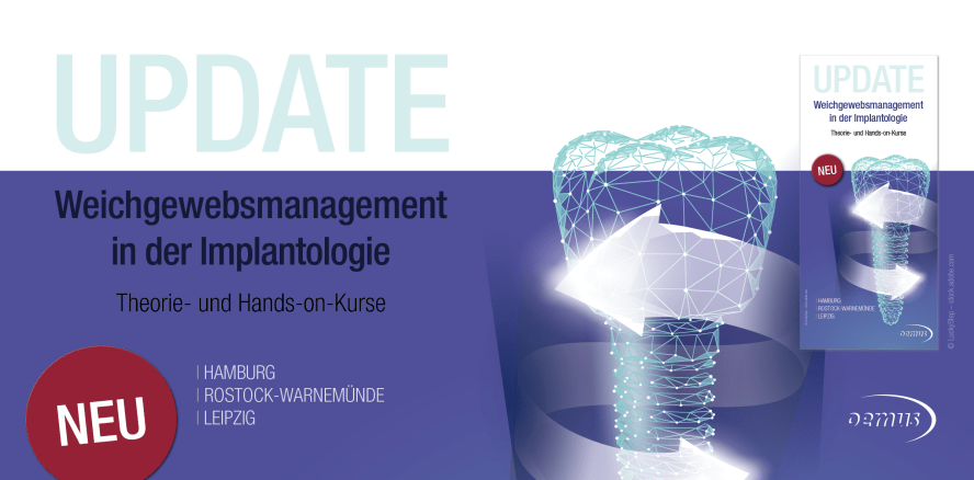 Weichgewebsmanagement in der Implantologie