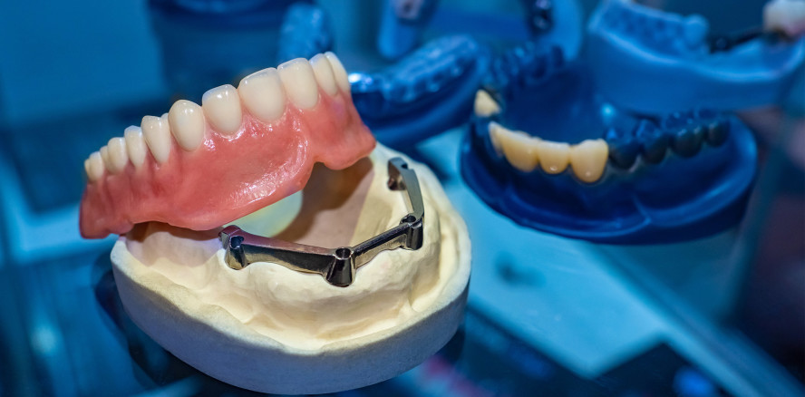 Neue Broschüre „Zahnersatz - Therapien, Kosten und Beratung“