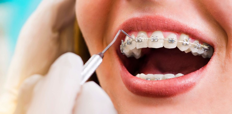 Prophylaxeprotokolle bei White-Spots im Vergleich