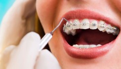 Prophylaxeprotokolle bei White-Spots im Vergleich
