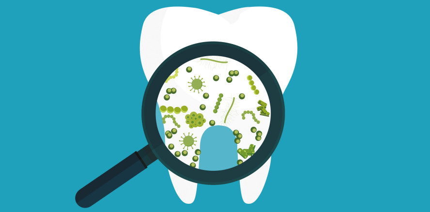 Wurzelbehandlung: Neue Erkenntnisse über Mikrobiom