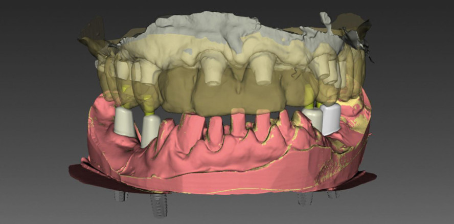 Komplexversorgung im Fokus – digital vs. analog