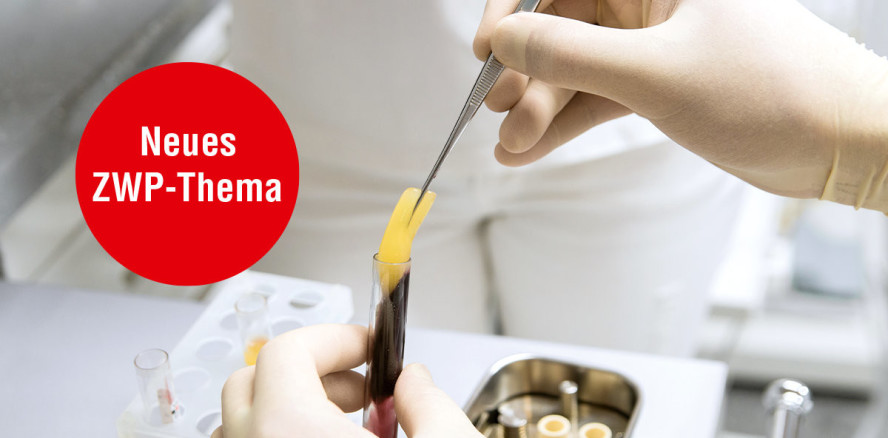 Jetzt online informieren: ZWP-Thema „Eigenblutkonzentrate (PRF)“