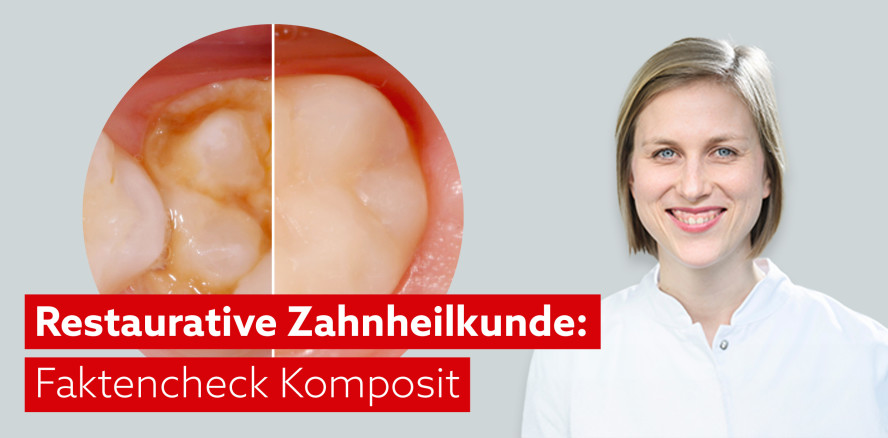 Nicht verpassen: Zum Einsatz indirekter Kompositrestaurationen