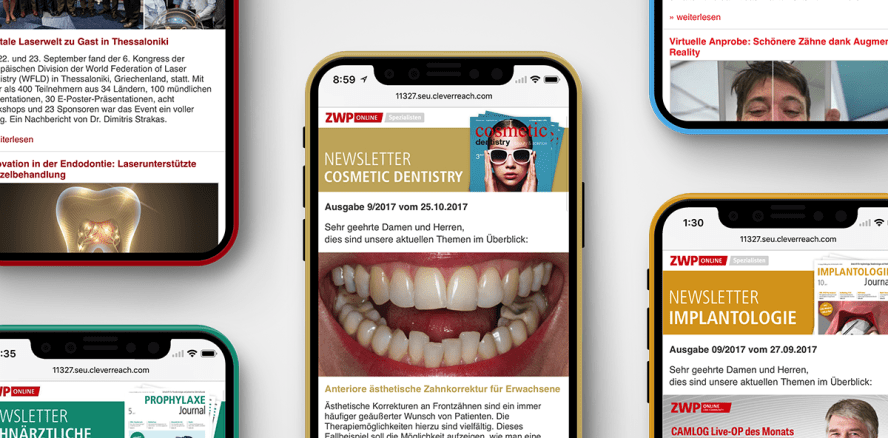 Fachlich up to date: Spezialisten-Newsletter Cosmetic Dentistry
