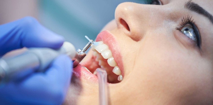 Zahnärzte fordern 219 € Jahresbudget für die PZR