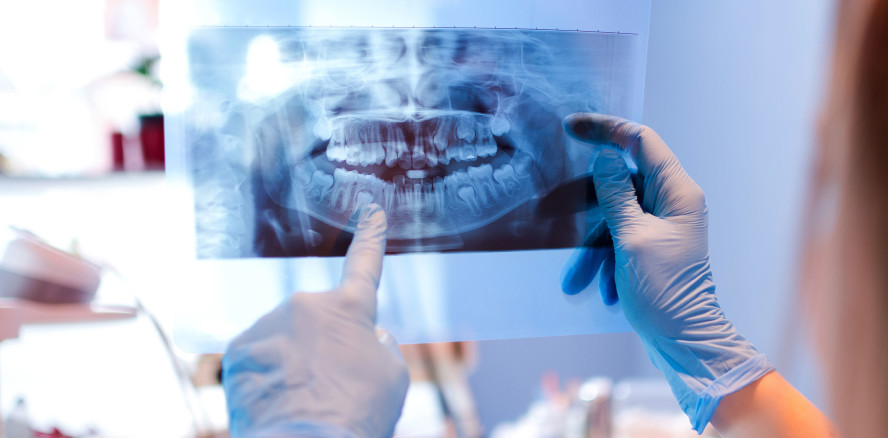 Strahlenschutz-Vorgaben häufig noch nicht umgesetzt