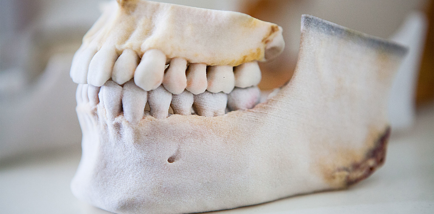 Zahngesundheit im Alter: Makrolide fördern Knochenregeneration