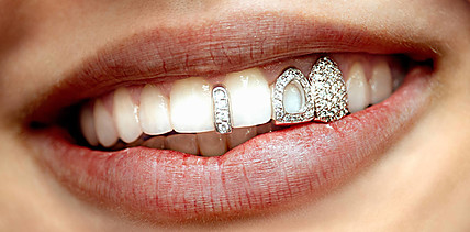 Bling-Bling-Spektakel in Berlin – Dental Jewelry Expo feiert Premiere