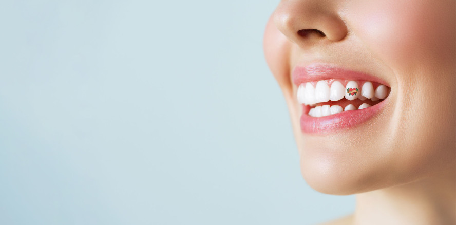 Pimp your teeth reloaded: Zahntattoos als fragwürdiger Social-Media-Trend