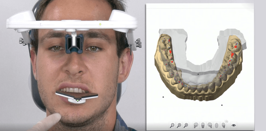 Neue Software zur Kieferregis­trierung: zebris JMA-Optic Version 3