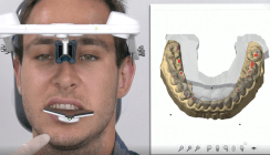 Neue Software zur Kieferregis­trierung: zebris JMA-Optic Version 3