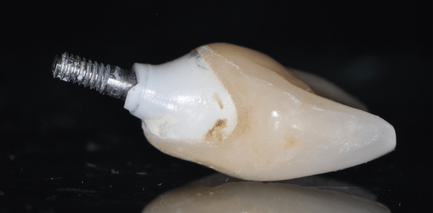 Zwischen Erfolg und Komplikationen – ein kritischer Blick