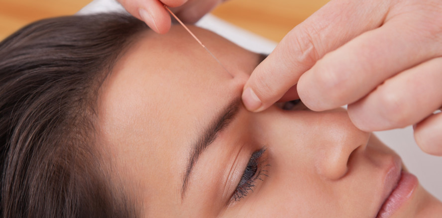 Akupunktur: Wie wirksam sind Nadeln bei einer Dentalphobie?