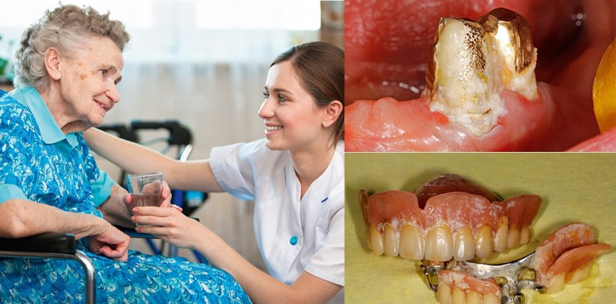 Betreuung von Hochrisikopatienten durch Prophylaxeassistentinnen?!