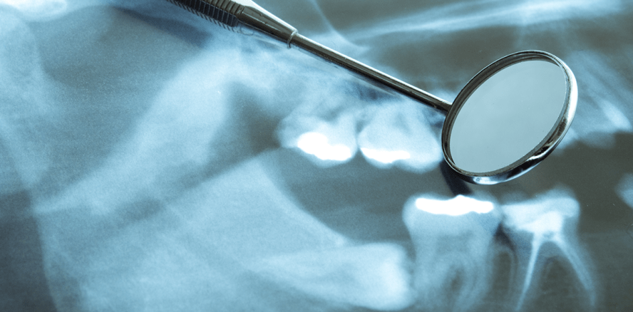 Umfrage: Zahnärzte klären nicht immer über Zusatzkosten auf