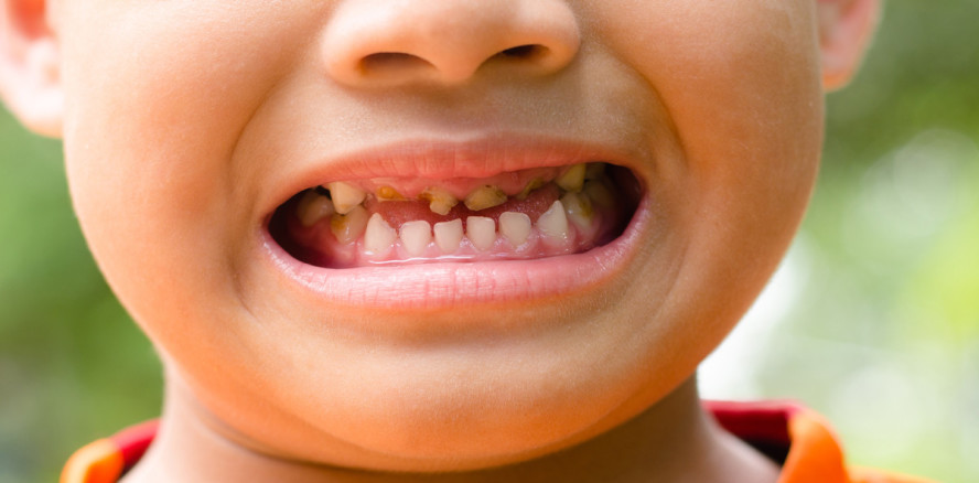 Zahnschmerzen waren für Aborigine-Kinder normal