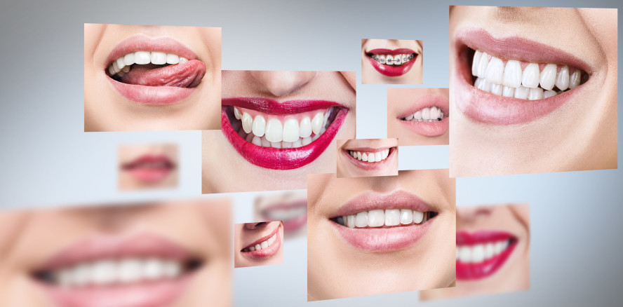 Zahngesundheitsziele: So sagt Australien Karies den Kampf an