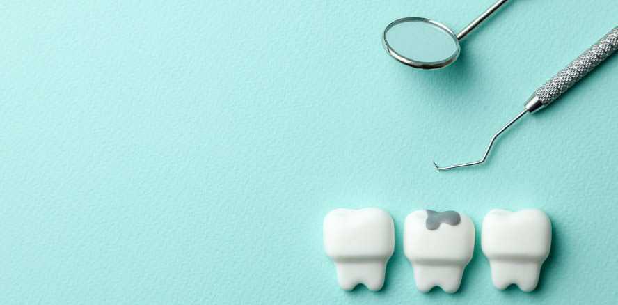 Zahnreport 2020: Mehr Karies bei Kindern als angenommen