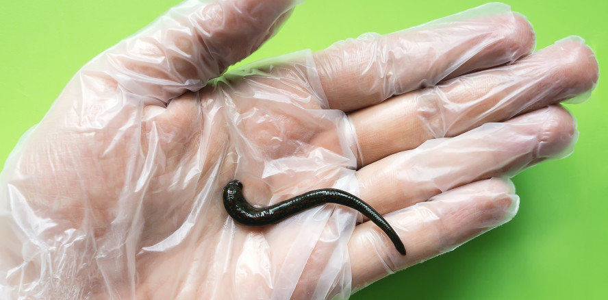 Ekel-Video im Netz: Ärzte entfernen lebenden Blutegel aus Rachen