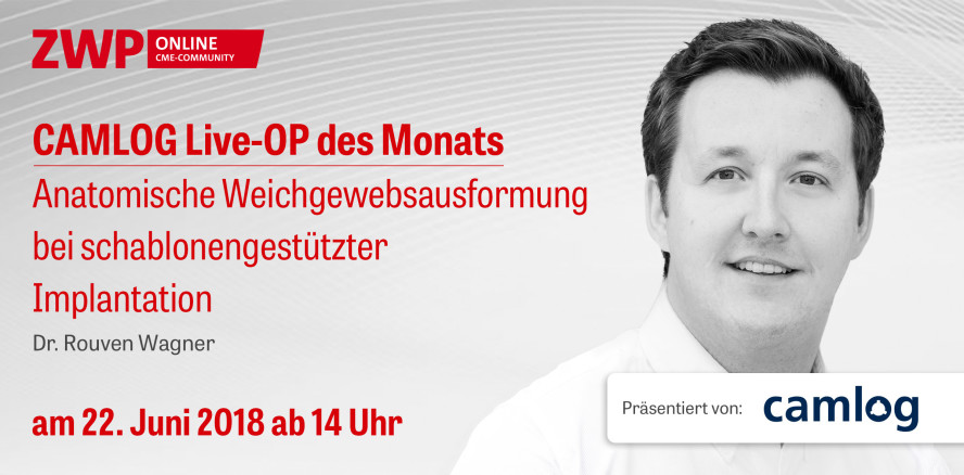 Jetzt vormerken: CAMLOG Live-OP am 22. Juni ab 14 Uhr