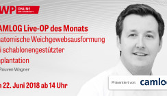 Jetzt vormerken: CAMLOG Live-OP am 22. Juni ab 14 Uhr