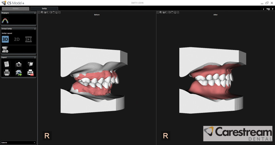Automatische Modellsegmentierung mit CS Model+