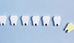 Österreichs Kinderzähne im Check