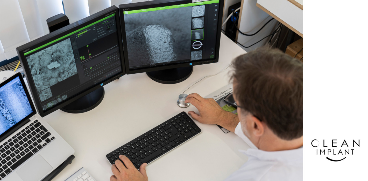 Studie zur Qualität dentaler Implantate: Erhebliche Unterschiede