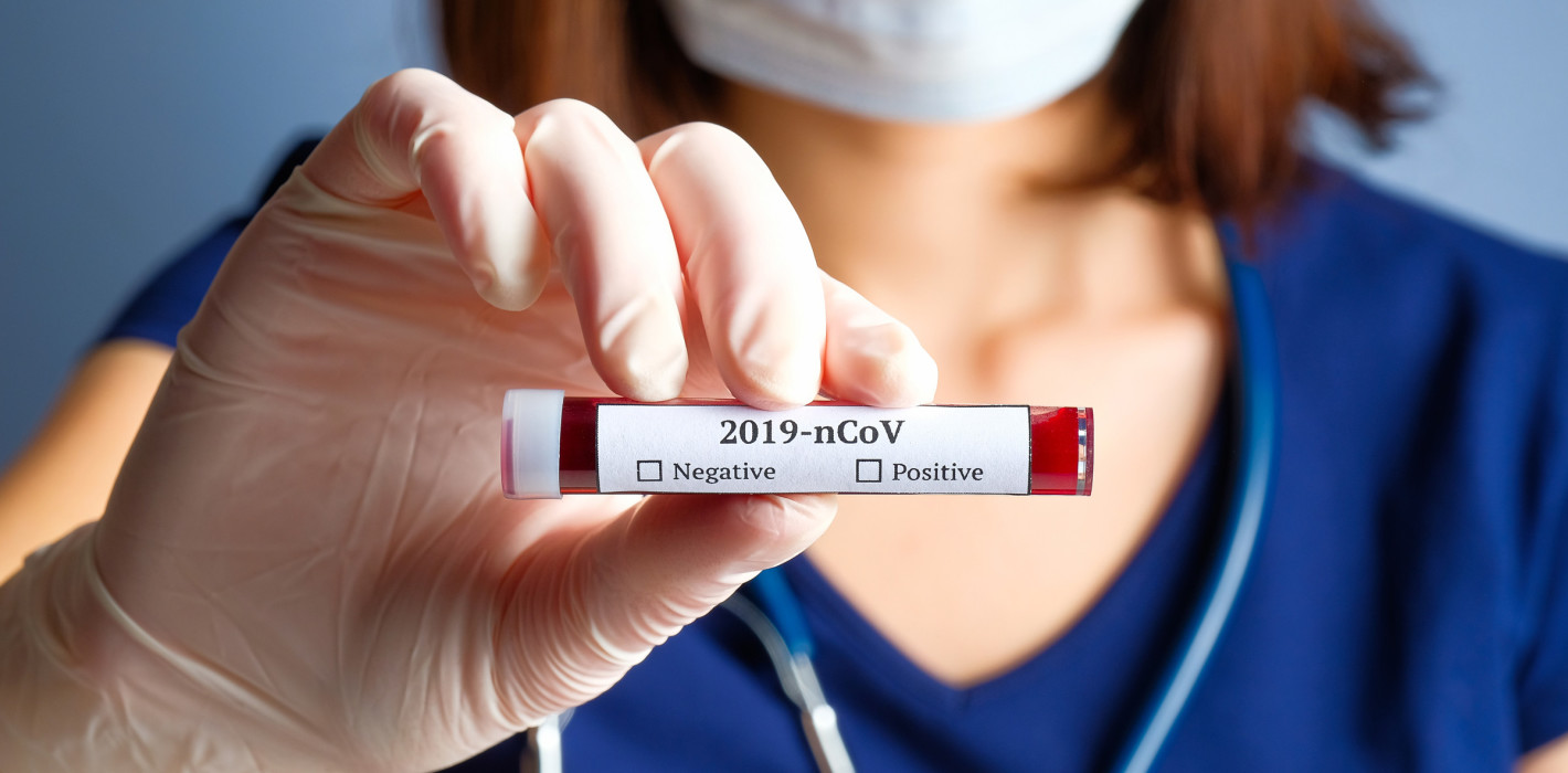 Coronavirus erreicht Österreich: Was ist zu tun?