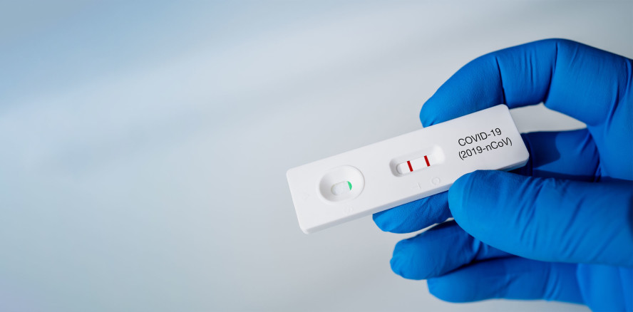 Corona: Antigen-Schnelltests für zahnärztliches Personal?