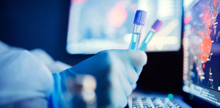 Vorsicht bei Corona Tests aus dem Internet