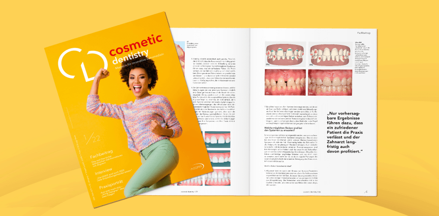 cosmetic dentistry 1/22 legt den Fokus auf Aligner