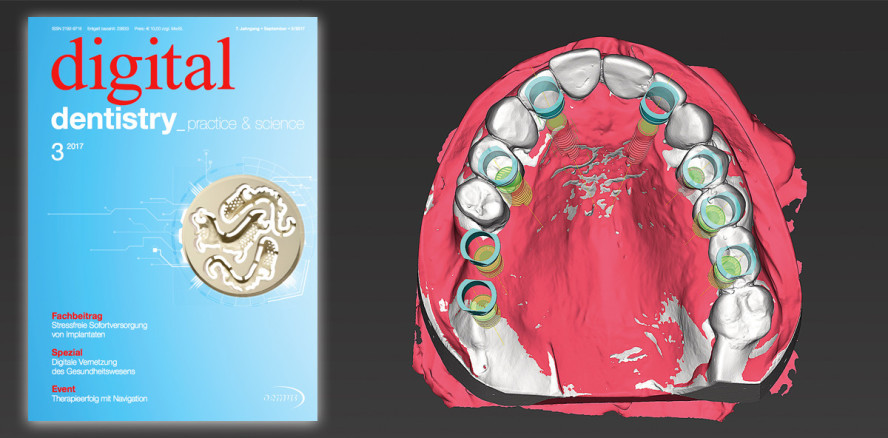 Aktuelle Ausgabe der digital dentistry jetzt vorab lesen