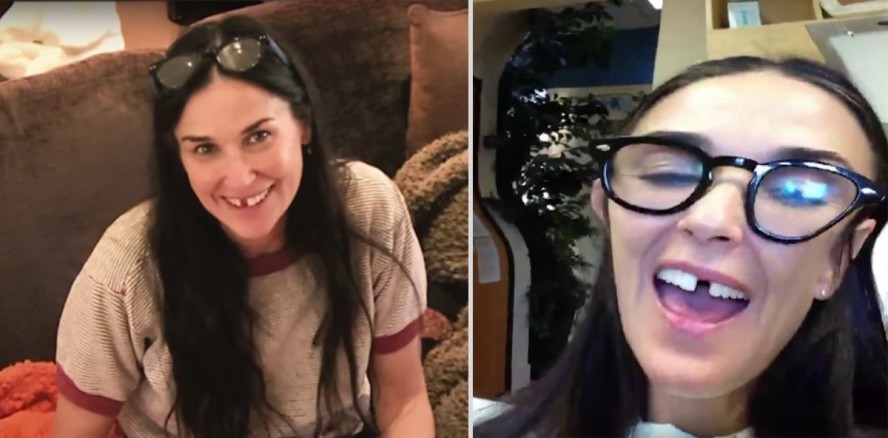 Demi Moore: Zwei Schneidezähne durch Stress verloren