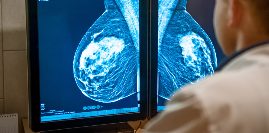 Dentale Stammzellen können Milchdrüsen regenerieren