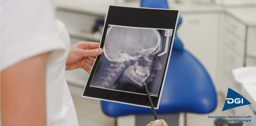 Kiefergelenk und Implantate – eine komplizierte Beziehung