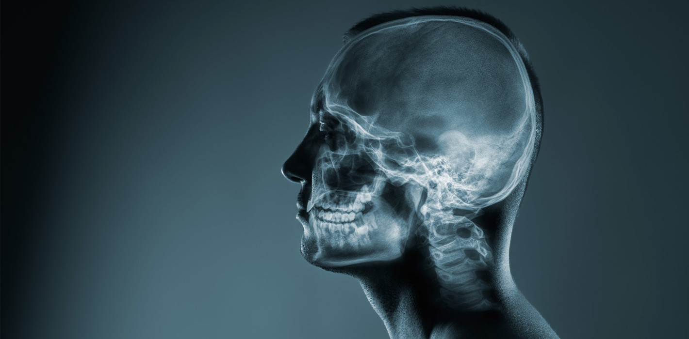 Update: S1-Leitlinie „Radiologische Diagnostik im Kopf-Hals-Bereich“