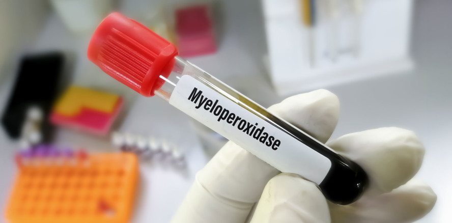 Neues Diagnoseverfahren erkennt Parodontitis: Ein Enzym als Biomarker