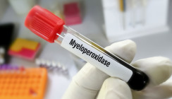 Neues Diagnoseverfahren erkennt Parodontitis: Ein Enzym als Biomarker