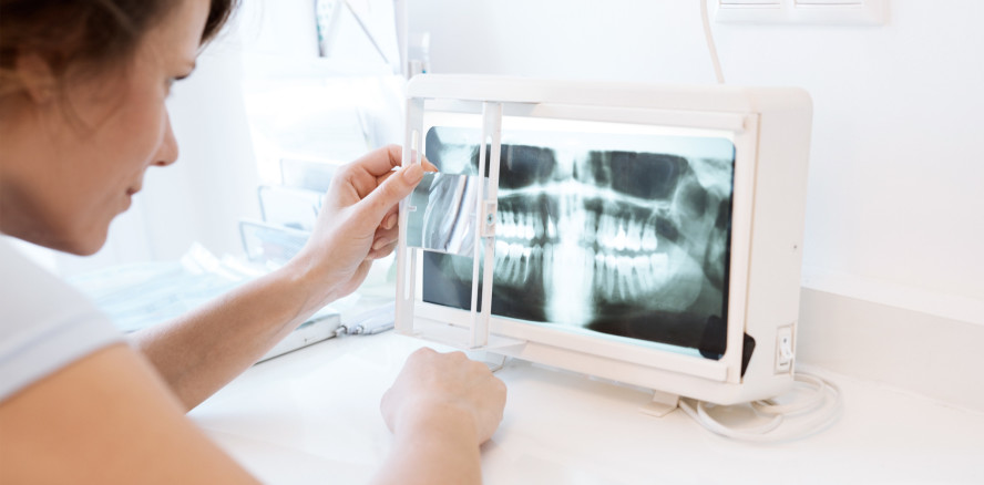 Alles einwandfrei? Befundung und Abrechnung von OPGs