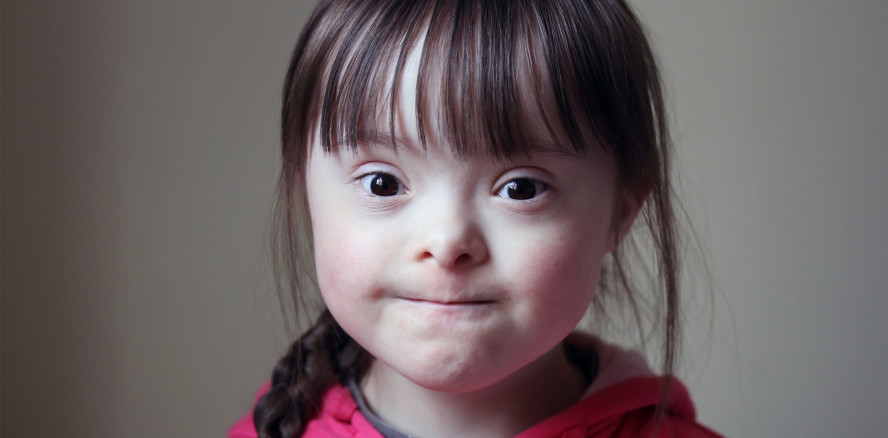 Mundgesundheit von Kindern mit Downsyndrom besonders gefährdet