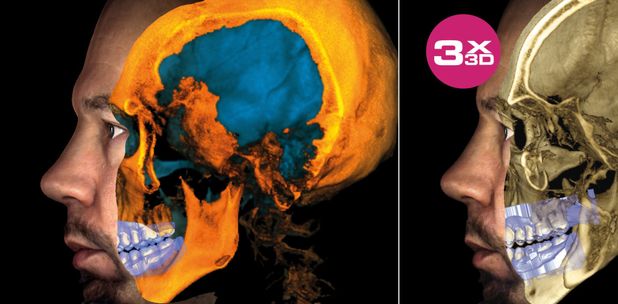 Wo der digitale Workflow noch etwas mehr kann