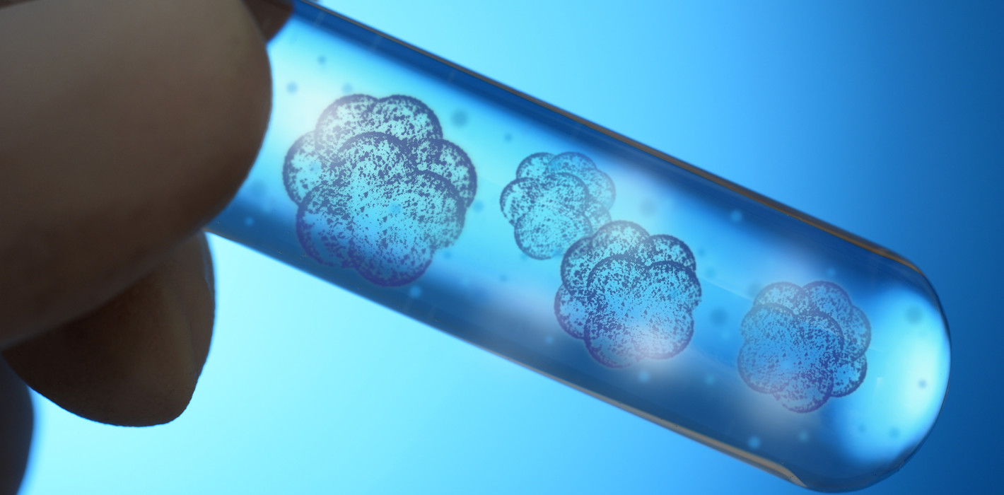 Implantate: Schnelleres Einheilen durch Stammzellen?