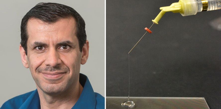 Wurzelkanalbehandlungen: Neues antimikrobielles Gel entwickelt